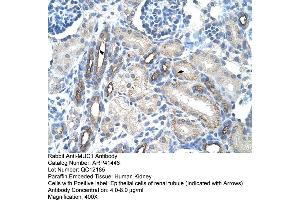 Rabbit Anti-MUC1 Antibody  Paraffin Embedded Tissue: Human Kidney Cellular Data: Epithelial cells of renal tubule Antibody Concentration: 4. (MUC1 antibody  (C-Term))