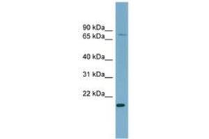 Image no. 1 for anti-PDZ Domain Containing Ring Finger 4 (PDZRN4) (AA 107-156) antibody (ABIN6743162) (PDZRN4 antibody  (AA 107-156))