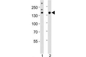 Western blot analysis of lysate from 1) HeLa cell line and 2) mouse cerebellum tissue using Kdm6b antibody at 1:1000. (Kdm6b antibody  (AA 1023-1057))