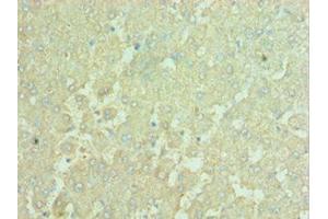 Immunohistochemistry of paraffin-embedded human liver tissue using ABIN7150150at dilution of 1:100 (APOBEC3C antibody  (AA 1-190))