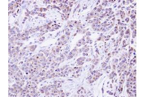 IHC-P Image Immunohistochemical analysis of paraffin-embedded SG xenograft , using alpha Glucosidase II, antibody at 1:500 dilution. (GANAB antibody  (C-Term))