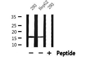 Western blot analysis of extracts from HepG2 and 293, using RPS19 Antibody.