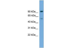 WB Suggested Anti-C16orf71 Antibody Titration: 0. (C16ORF71 antibody  (Middle Region))