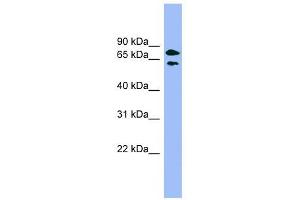 PANK4 antibody used at 1 ug/ml to detect target protein. (PANK4 antibody  (Middle Region))
