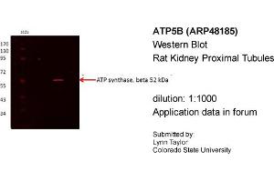 Western Blotting (WB) image for anti-ATP Synthase, H+ Transporting, Mitochondrial F1 Complex, beta Polypeptide (ATP5B) (N-Term) antibody (ABIN2783268) (ATP5B antibody  (N-Term))