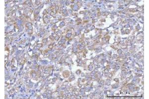 IHC analysis of Hamartin/TSC1 using anti-Hamartin/TSC1 antibody (ABIN7599499). (TSC1 antibody  (AA 1-618))