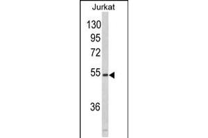 Western blot analysis of MFAP1 in Jurkat cell line lysates (35ug/lane)