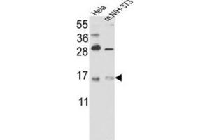 Western Blotting (WB) image for anti-RNA Binding Motif Protein 3 (RBM3) antibody (ABIN3003187) (RBM3 antibody)