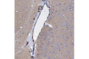 IHC analysis of EHD3 using anti-EHD3 antibody (ABIN7602777). (EHD3 antibody  (C-Term))