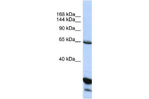 Host:  Rabbit  Target Name:  UNC5C  Sample Type:  HepG2 Whole Cell lysates  Antibody Dilution:  1. (Unc5c antibody  (C-Term))
