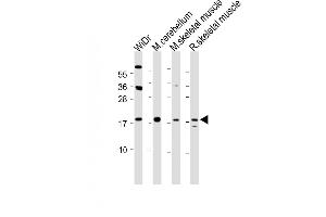 TPPP3 Antikörper  (AA 117-146)