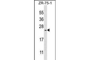 BarX1 Antibody (C-term) (ABIN391427 and ABIN2841420) western blot analysis in ZR-75-1 cell line lysates (35 μg/lane). (BARX1 antibody  (AA 119-148))