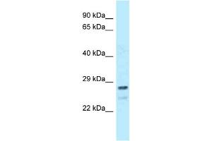 WB Suggested Anti-FKBP14 Antibody Titration: 1. (FKBP14 antibody  (Middle Region))