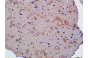 Formalin-fixed and paraffin embedded  labeled with Rabbit Anti- Polyclonal Antibody, Unconjugated at 1:200 followed by conjugation to the secondary antibody and DAB staining (Kelch-Like 24 antibody  (AA 1-100))