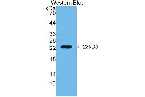 Western Blotting (WB) image for anti-Peptidoglycan Recognition Protein 1 (PGLYRP1) (AA 22-196) antibody (ABIN3204214) (PGLYRP1 antibody  (AA 22-196))