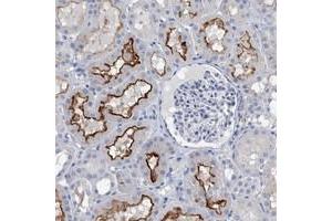Immunohistochemical staining of human kidney with SLC34A3 polyclonal antibody  shows distinct membranous positivity in cells in tubules at 1:20-1:50 dilution. (SLC34A3 antibody)