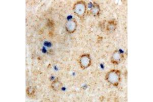 Immunohistochemical analysis of GLUR4 staining in human brain formalin fixed paraffin embedded tissue section.