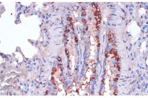 Immunohistochemistry of paraffin-embedded Rat lung using RPL22 Polyclonal Antibody at dilution of 1:100 (40x lens). (RPL22 antibody)