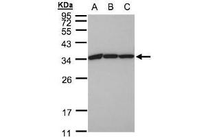 WB Image Sample(30 ug whole cell lysate) A:A431, B:H1299 C:HeLa S3, 12% SDS PAGE antibody diluted at 1:1000 (EEF1B2 antibody)