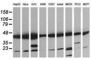 Image no. 8 for anti-Mitogen-Activated Protein Kinase Kinase 1 (MAP2K1) antibody (ABIN1499385) (MEK1 antibody)