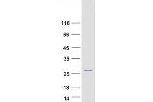 Western Blotting (WB) image for BCL2-Associated Agonist of Cell Death (BAD) (Transcript Variant 1) protein (Myc-DYKDDDDK Tag) (ABIN2715201)