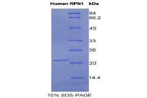 SDS-PAGE (SDS) image for Ribophorin 1 (RPN1) (AA 24-179) protein (His tag) (ABIN1981106) (RPN1 Protein (AA 24-179) (His tag))