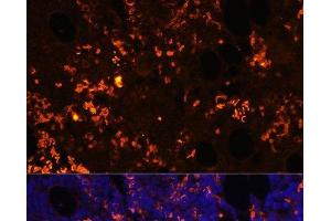 Immunofluorescence analysis of Rat bone marrow cells using GPR55 Polyclonal Antibody at dilution of 1:100. (GPR55 antibody)