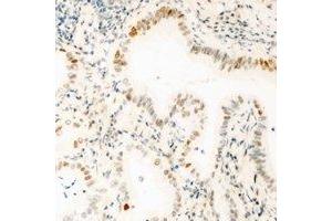 Immunohistochemical analysis of GABPB1 staining in mouse kidney formalin fixed paraffin embedded tissue section. (GABPB1 antibody)