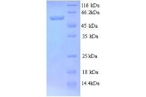 SDS-PAGE (SDS) image for Cystathionine-beta-Synthase (CBS) (AA 1-507), (full length) protein (His tag) (ABIN5713320) (CBS Protein (AA 1-507, full length) (His tag))