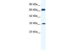 KCNN1 antibody used at 1. (KCNN1 antibody  (C-Term))