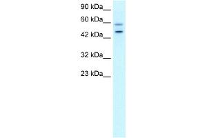 WB Suggested Anti-DKFZP761C169 Antibody Titration:  0. (GC-Rich Promoter Binding Protein 1 (GPBP1) (N-Term) antibody)