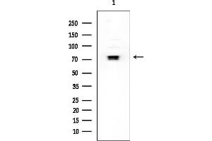 anti-GATA Zinc Finger Domain Containing 2A (GATAD2A) antibody