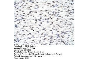 Rabbit Anti-HNRPLL Antibody  Paraffin Embedded Tissue: Human Heart Cellular Data: Myocardial cells Antibody Concentration: 4. (HNRPLL antibody  (N-Term))
