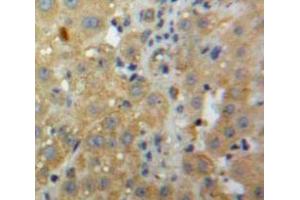 Used in DAB staining on fromalin fixed paraffin-embedded Liver tissue (CXCL2 antibody  (AA 28-100))
