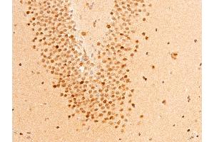 ABIN6267303 at 1/100 staining mouse brain tissue sections by IHC-P.