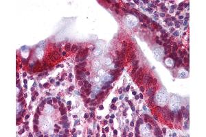 Immunohistochemistry (IHC) image for anti-Hepatocyte Nuclear Factor 4, alpha (HNF4A) (Middle Region) antibody (ABIN2779763) (HNF4A antibody  (Middle Region))
