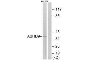 Western blot analysis of extracts from MCF-7 cells, using ABHD9 antibody. (ABHD9 antibody)