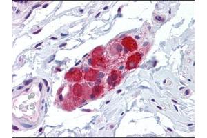 Human Small Intestine, submucosal plexus: Formalin-Fixed, Paraffin-Embedded (FFPE) (TRPV2 antibody  (Ser157))