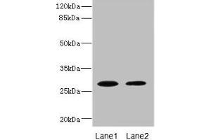 Western blot All lanes: TPK1 antibody at 0. (TPK1 antibody  (AA 1-243))