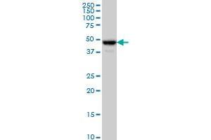 Western Blotting (WB) image for anti-Chromosome 17 Open Reading Frame 75 (C17orf75) (AA 1-100) antibody (ABIN566240)
