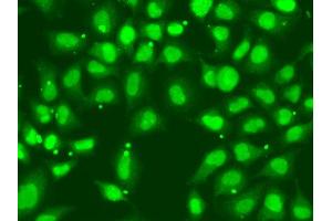 Immunofluorescence analysis of A549 cell using FANCD2 antibody. (FANCD2 antibody)