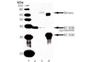 Image no. 1 for anti-Superoxide Dismutase 3, Extracellular (SOD3) antibody (ABIN363993) (SOD3 antibody)