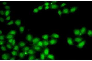 Immunofluorescence analysis of A-549 cells using GGH Polyclonal Antibody (GGH antibody)