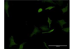 Immunofluorescence (IF) image for anti-Hematopoietically Expressed Homeobox (HHEX) (AA 133-237) antibody (ABIN516433)