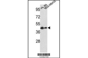 Western blot analysis of GSDMB Antibody in HL-60, MDA-MB435 cell line lysates (35ug/lane) (Gasdermin B antibody  (AA 208-237))
