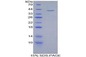 SDS-PAGE (SDS) image for Corin, Serine Peptidase (CORIN) (AA 70-136) protein (His tag,GST tag) (ABIN2122703) (Corin Protein (AA 70-136) (His tag,GST tag))