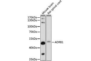 Western blot analysis of extracts of various cell lines, using  antibody (ABIN7265502) at 1:1000 dilution. (ADRB1 antibody  (AA 150-250))