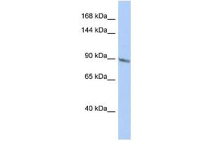 TBC1D2B antibody  (Middle Region)