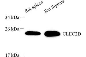 Western blot analysis of CLEC2D (ABIN7073248) at dilution of 1: 1000