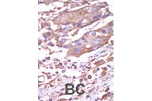 Immunohistochemistry (IHC) image for anti-Calcium/calmodulin-Dependent Protein Kinase II alpha (CAMK2A) antibody (ABIN3003046) (CAMK2A antibody)